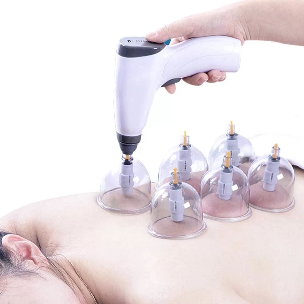Suction Cup AntiCellulite Elec - Cupping Therapy Set 评论和价格