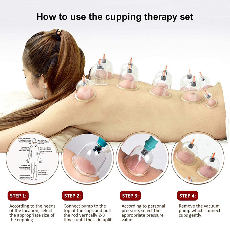 6or24  Pieces Suction Cups Mas - Cupping Therapy Set 评论和价格