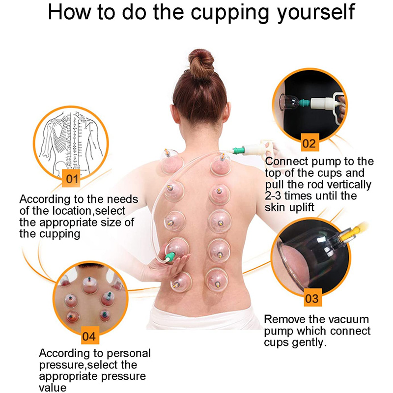 6or24  Pieces Suction Cups Mas - Cupping Therapy Set 评论和价格