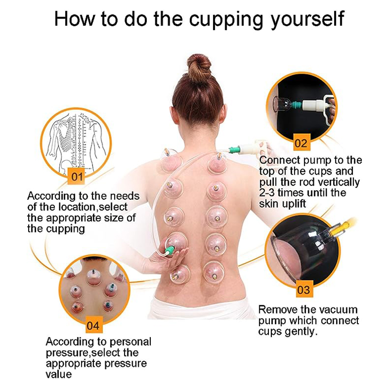 24 Cans JINGKANG Chinese Vacuu - Cupping Therapy Set 评论和价格