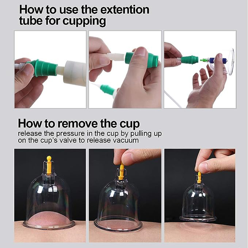 24 Cans JINGKANG Chinese Vacuu - Cupping Therapy Set 评论和价格