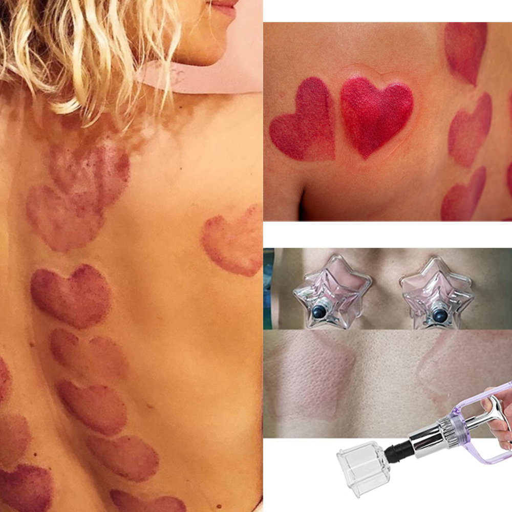 New Style 4 PCS Love-star Shap - Cupping Therapy Set 评论和价格
